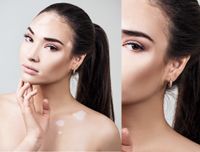 Before and after pigment spots treatment | Meo Skin Repair in Dusseldorf